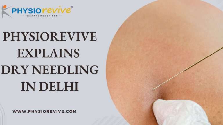 Dry Needling in Delhi