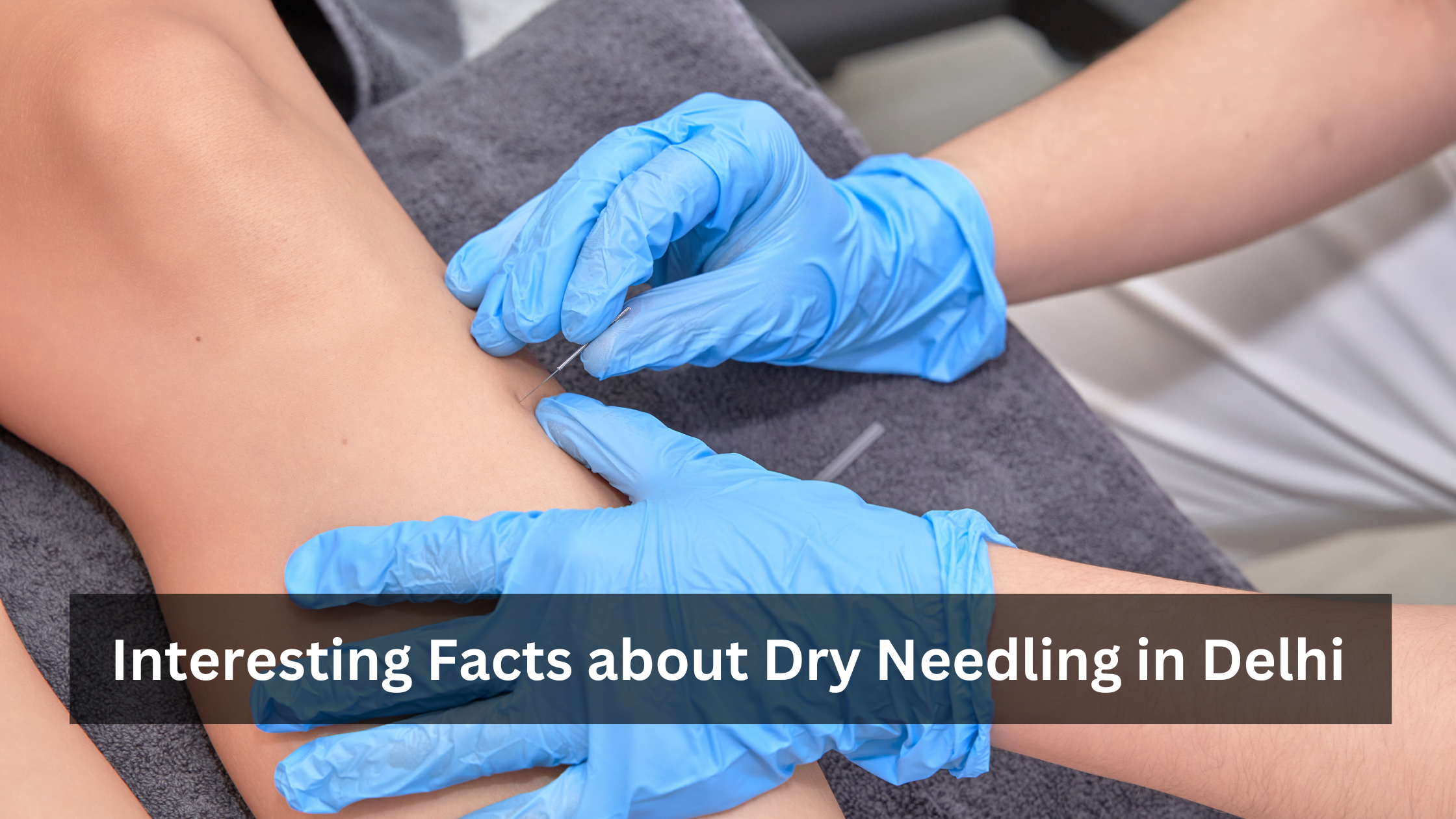 Interesting Facts about Dry Needling in Delhi